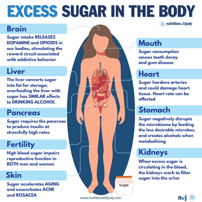excess sugar risks